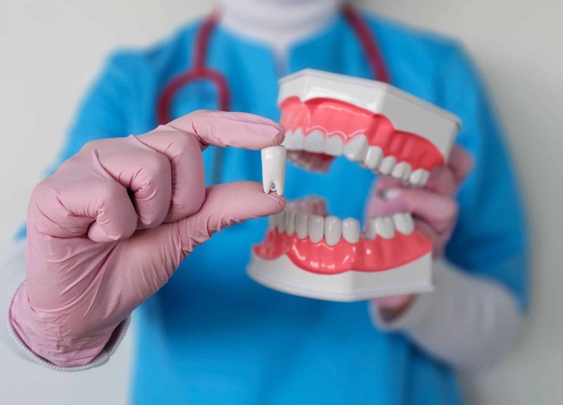 Tooth Extraction Kansas City